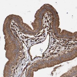 ZNF347 Antibody, Novus Biologicals 25 &mu;L; Unlabeled:Antibodies, Polyclonal