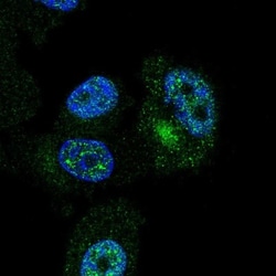 ZNF35 Antibody, Novus Biologicals 25 &mu;L, Unlabeled:Antibodies, Polyclonal