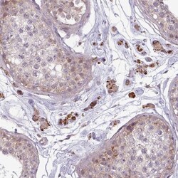 ZNF35 Antibody, Novus Biologicals:Antibodies:Primary Antibodies
