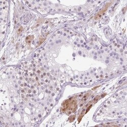 ZNF35 Antibody, Novus Biologicals 25 &mu;L, Unlabeled:Antibodies, Polyclonal