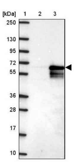 ZNF35 Antibody, Novus Biologicals:Antibodies:Primary Antibodies
