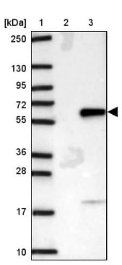 ZNF35 Antibody, Novus Biologicals 25 &mu;L, Unlabeled:Antibodies, Polyclonal