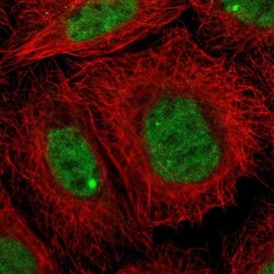 ZNF350 Antibody, Novus Biologicals 0.1mL; Unlabeled:Antibodies, Polyclonal