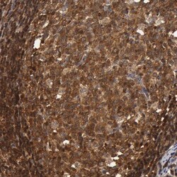 ZNF350 Antibody, Novus Biologicals 0.1mL; Unlabeled:Antibodies, Polyclonal