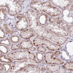 ZNF354A Antibody, Novus Biologicals:Antibodies:Primary Antibodies