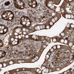 ZNF358 Antibody, Novus Biologicals 0.1mL; Unlabeled:Antibodies, Polyclonal
