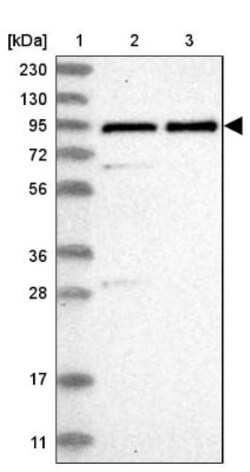 ZNF358 Antibody, Novus Biologicals 0.1mL; Unlabeled:Antibodies, Polyclonal