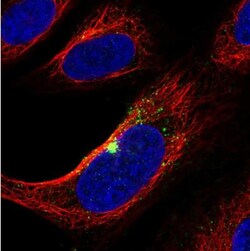 ZNF365 Antibody, Novus Biologicals 25 &mu;L, Unlabeled:Antibodies, Polyclonal