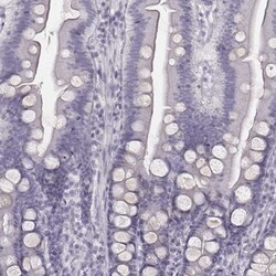 ZNF365 Antibody, Novus Biologicals 25 &mu;L, Unlabeled:Antibodies, Polyclonal