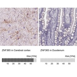 ZNF365 Antibody, Novus Biologicals 25 &mu;L, Unlabeled:Antibodies, Polyclonal