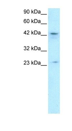 ZNF365 Antibody, Novus Biologicals 100μL; Unlabeled:Antibodies, Polyclonal