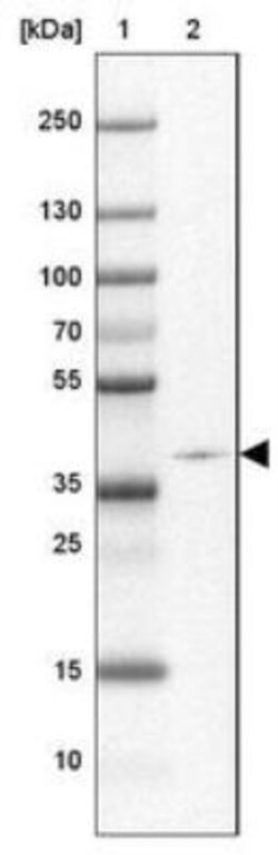 ZNF365 Antibody, Novus Biologicals 25 &mu;L, Unlabeled:Antibodies, Polyclonal