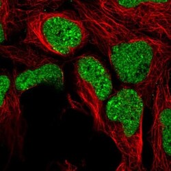 ZNF382 Antibody, Novus Biologicals:Antibodies:Primary Antibodies