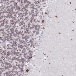 ZNF382 Antibody, Novus Biologicals:Antibodies:Primary Antibodies