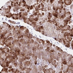 ZNF383 Antibody, Novus Biologicals:Antibodies:Primary Antibodies