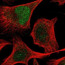 ZNF394 Antibody, Novus Biologicals 0.1mL; Unlabeled:Antibodies, Polyclonal