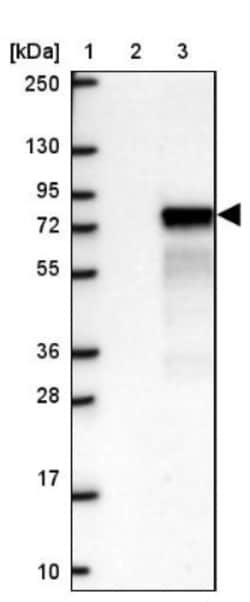 ZNF394 Antibody, Novus Biologicals 0.1mL; Unlabeled:Antibodies, Polyclonal