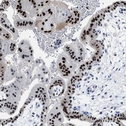 ZNF406 Antibody, Novus Biologicals 25 &mu;L, Unlabeled:Antibodies, Polyclonal