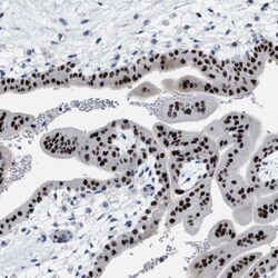 ZNF406 Antibody, Novus Biologicals 25 &mu;L, Unlabeled:Antibodies, Polyclonal