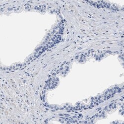 ZNF406 Antibody, Novus Biologicals 25 &mu;L, Unlabeled:Antibodies, Polyclonal