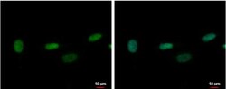 ZNF419A Antibody, Novus Biologicals 0.1mL; Unlabeled:Antibodies, Polyclonal