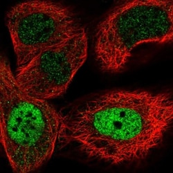 ZNF426 Antibody, Novus Biologicals 25 &mu;L; Unlabeled:Antibodies, Polyclonal