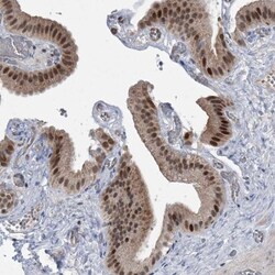 ZNF426 Antibody, Novus Biologicals 25 &mu;L; Unlabeled:Antibodies, Polyclonal