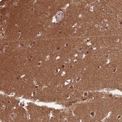 ZNF436 Antibody, Novus Biologicals 0.1mL; Unlabeled:Antibodies, Polyclonal