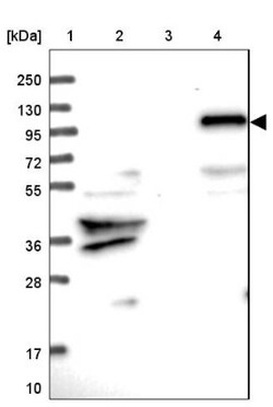 ZNF438 Antibody, Novus Biologicals 0.1mL; Unlabeled:Antibodies, Polyclonal
