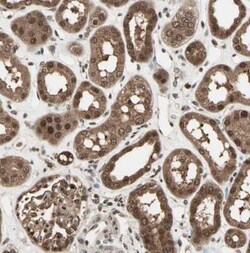 ZNF44 Antibody, Novus Biologicals 0.1mL; Unlabeled:Antibodies, Polyclonal