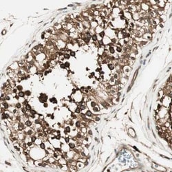 ZNF443 Antibody, Novus Biologicals:Antibodies:Primary Antibodies