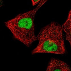 ZNF444 Antibody, Novus Biologicals:Antibodies:Primary Antibodies