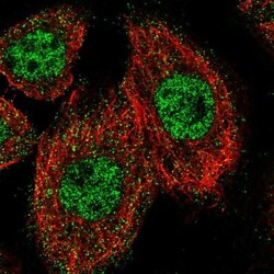 ZNF449 Antibody, Novus Biologicals:Antibodies:Primary Antibodies