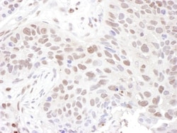 ZNF462 Antibody, Novus Biologicals 0.1mg; Unlabeled:Antibodies, Polyclonal