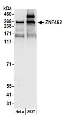 ZNF462 Antibody, Novus Biologicals 0.1mg; Unlabeled:Antibodies, Polyclonal