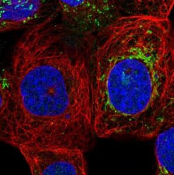 ZNF48 Antibody, Novus Biologicals 0.1 mL | Buy Online | Novus Biologicals | Fisher Scientific