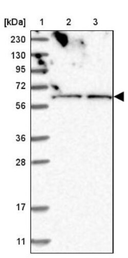 ZNF48 Antibody, Novus Biologicals 0.1 mL | Buy Online | Novus Biologicals | Fisher Scientific