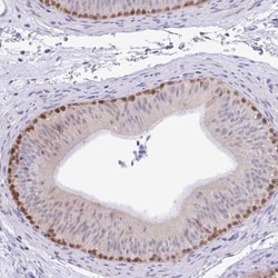 ZNF485 Antibody, Novus Biologicals 0.1mL; Unlabeled:Antibodies, Polyclonal