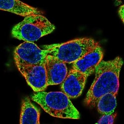 ZNF501 Antibody, Novus Biologicals 0.1mL; Unlabeled:Antibodies, Polyclonal