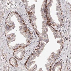 ZNF502 Antibody, Novus Biologicals 25 &mu;L | Buy Online | Novus Biologicals | Fisher Scientific