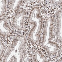 ZNF503 Antibody, Novus Biologicals 25 &mu;L; Unlabeled:Antibodies, Polyclonal