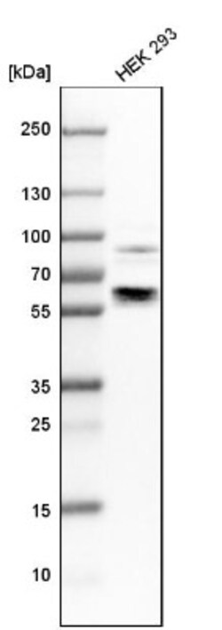 ZNF503 Antibody, Novus Biologicals 25 &mu;L; Unlabeled:Antibodies, Polyclonal