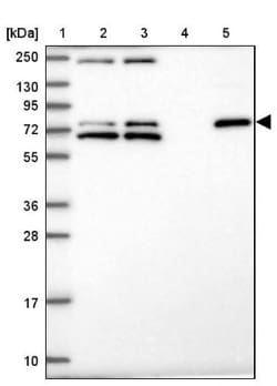 ZNF510 Antibody, Novus Biologicals 25 &mu;L, Unlabeled:Antibodies, Polyclonal