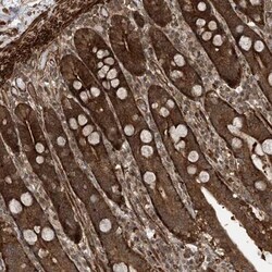 ZNF511 Antibody, Novus Biologicals 0.1mL; Unlabeled:Antibodies, Polyclonal