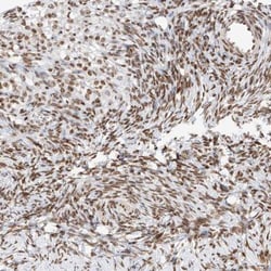 ZNF512 Antibody, Novus Biologicals 0.1mL; Unlabeled:Antibodies, Polyclonal