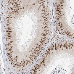 ZNF514 Antibody, Novus Biologicals:Antibodies:Primary Antibodies