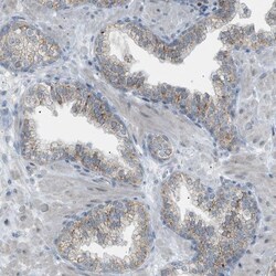ZNF516 Antibody, Novus Biologicals 25 &mu;L | Buy Online | Novus Biologicals | Fisher Scientific