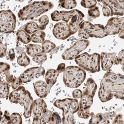 ZNF521 Antibody, Novus Biologicals:Antibodies:Primary Antibodies