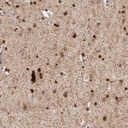 ZNF521 Antibody, Novus Biologicals:Antibodies:Primary Antibodies