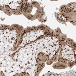 ZNF521 Antibody, Novus Biologicals:Antibodies:Primary Antibodies